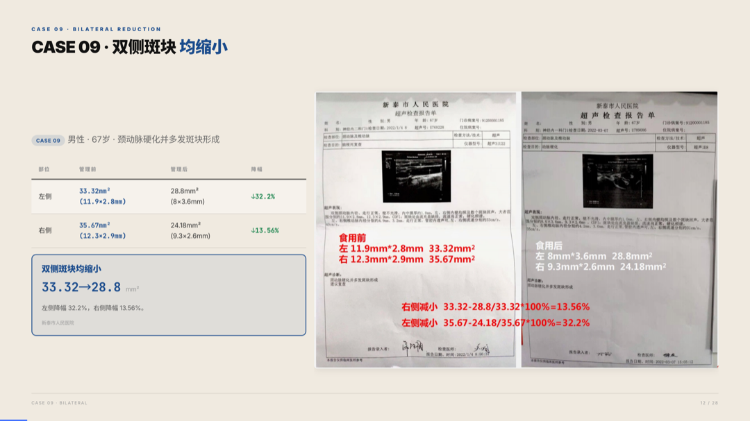 雅之林 心脑血管 案例分析 第12页