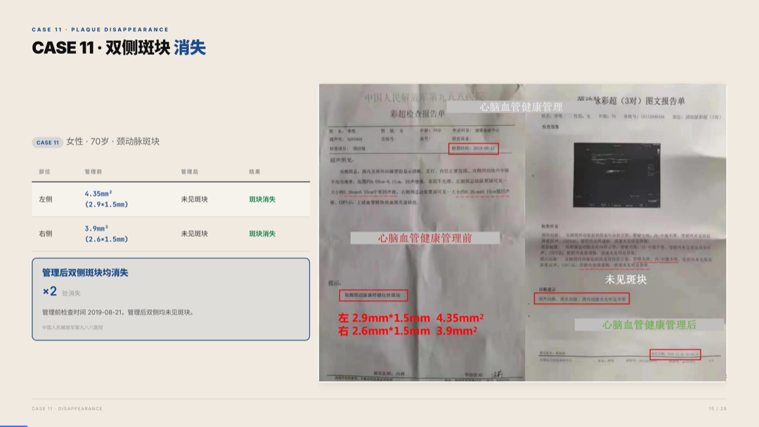 雅之林 心脑血管 案例分析 第15页