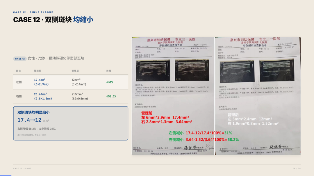 雅之林 心脑血管 案例分析 第16页
