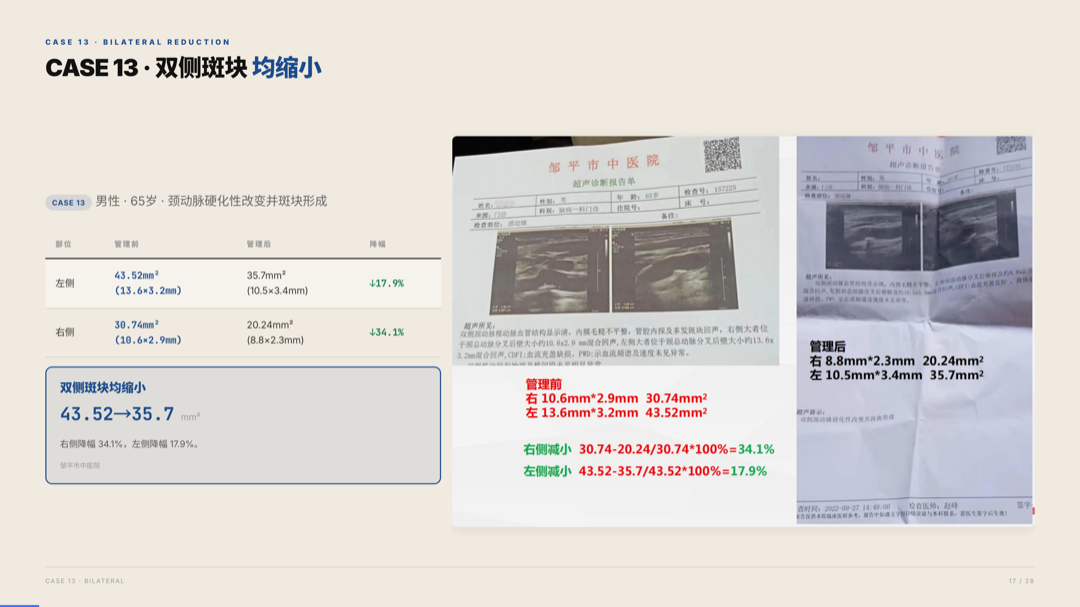 雅之林 心脑血管 案例分析 第17页