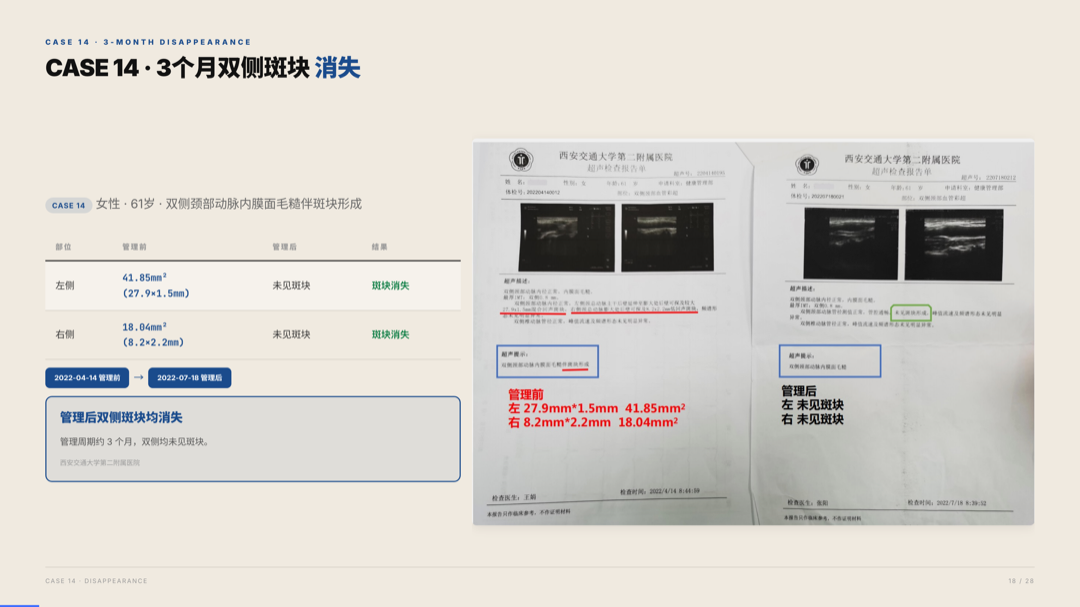 雅之林 心脑血管 案例分析 第18页