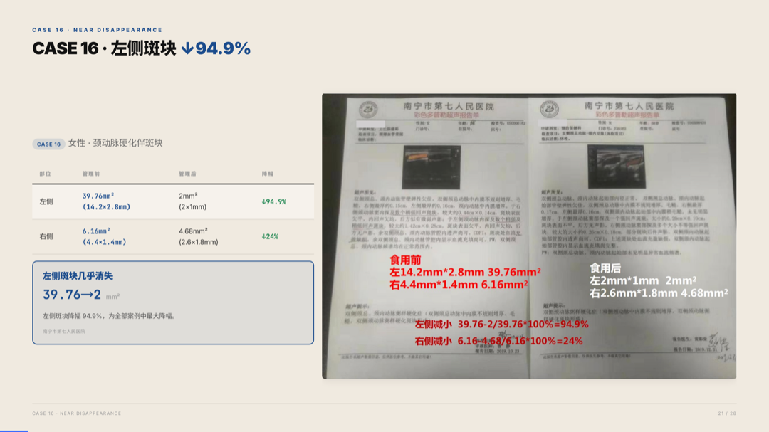雅之林 心脑血管 案例分析 第21页