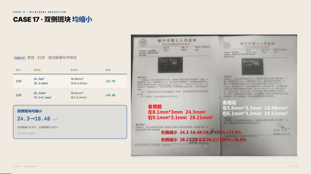 雅之林 心脑血管 案例分析 第22页