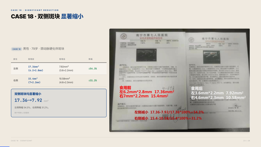 雅之林 心脑血管 案例分析 第23页