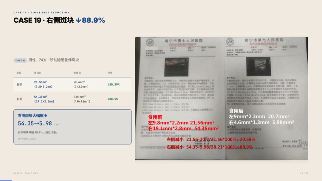 雅之林 心脑血管 案例分析 第24页