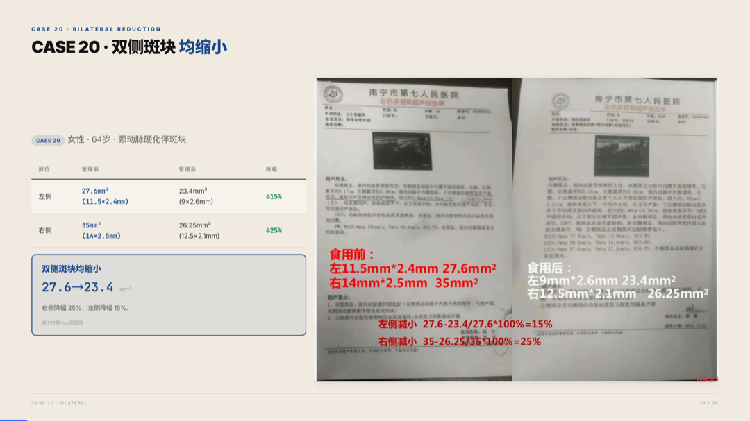 雅之林 心脑血管 案例分析 第25页