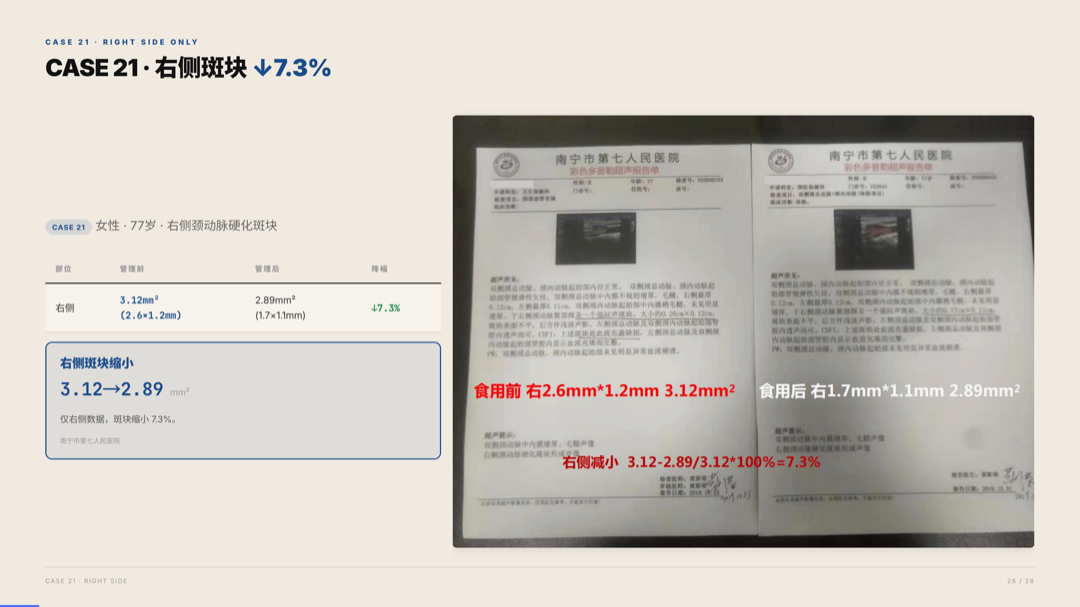 雅之林 心脑血管 案例分析 第26页
