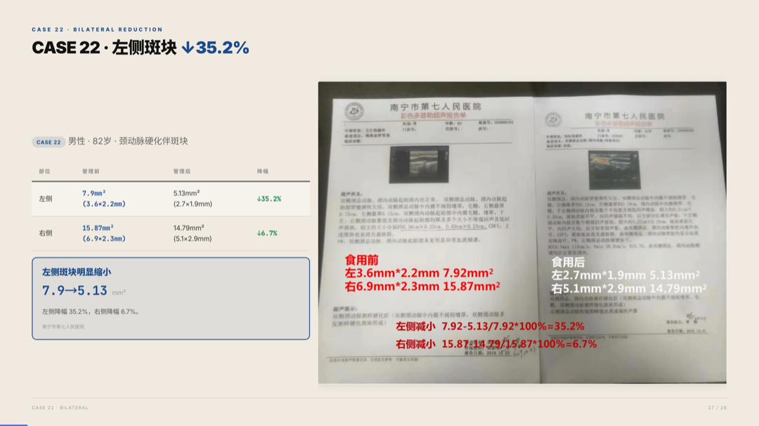 雅之林 心脑血管 案例分析 第27页