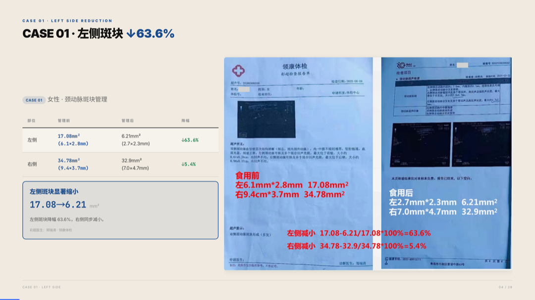雅之林 心脑血管 案例分析 第4页