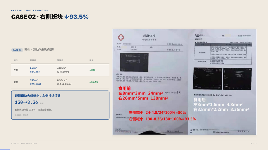 雅之林 心脑血管 案例分析 第5页