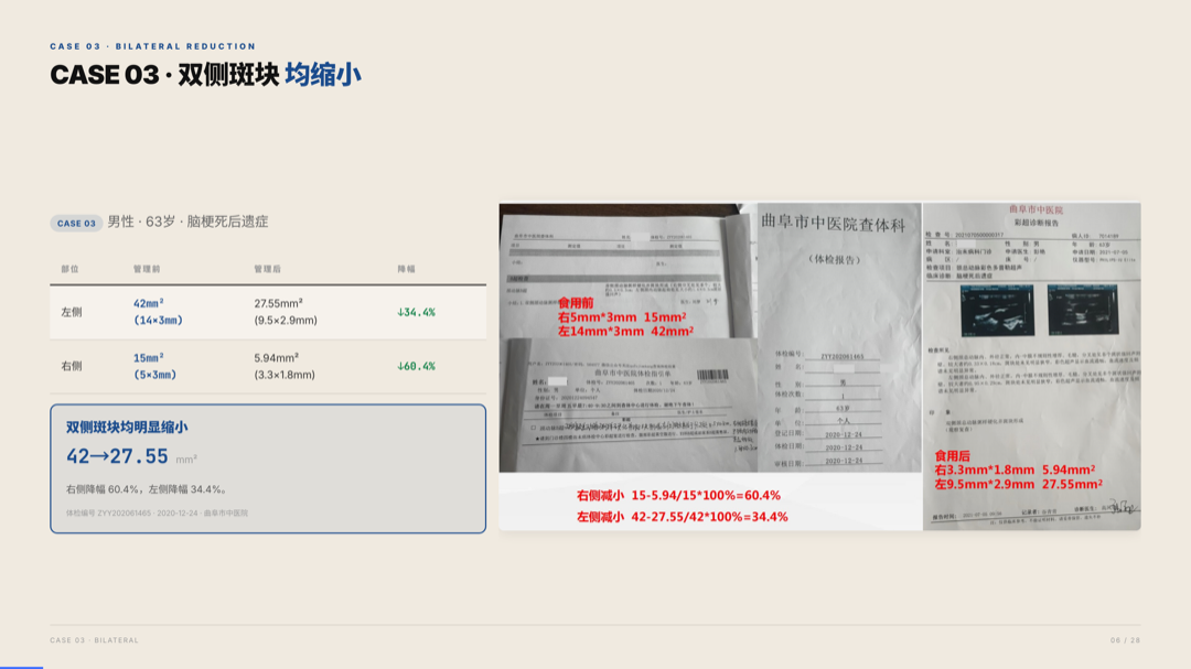 雅之林 心脑血管 案例分析 第6页
