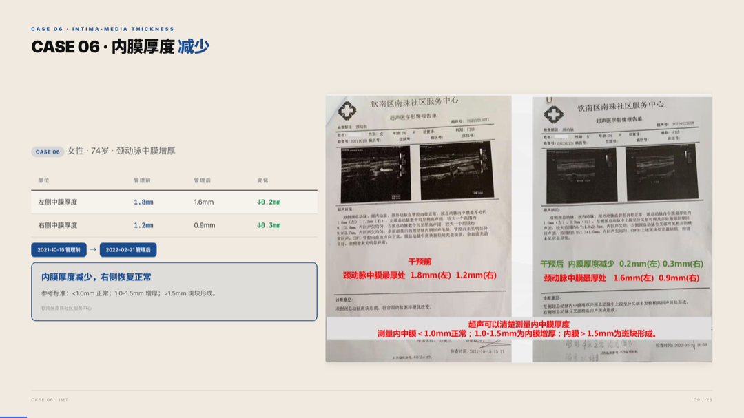 雅之林 心脑血管 案例分析 第9页