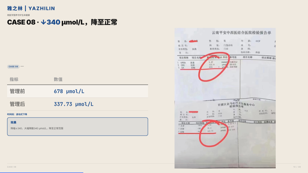 雅之林 痛风高尿酸 案例分析 第10页