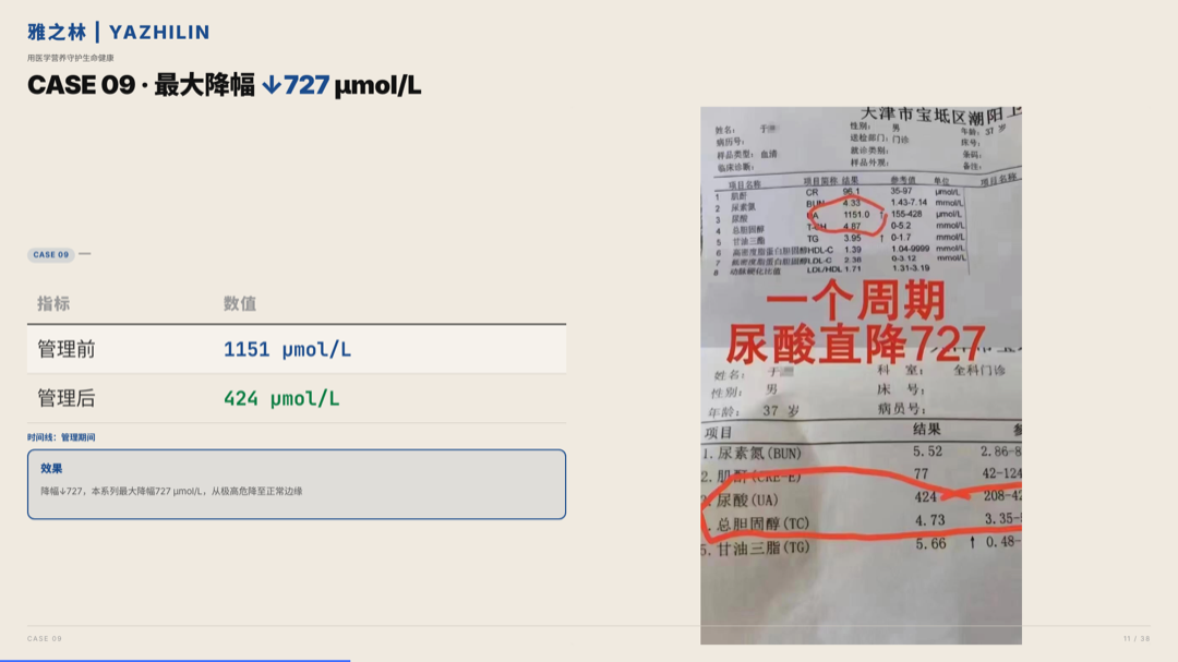 雅之林 痛风高尿酸 案例分析 第11页