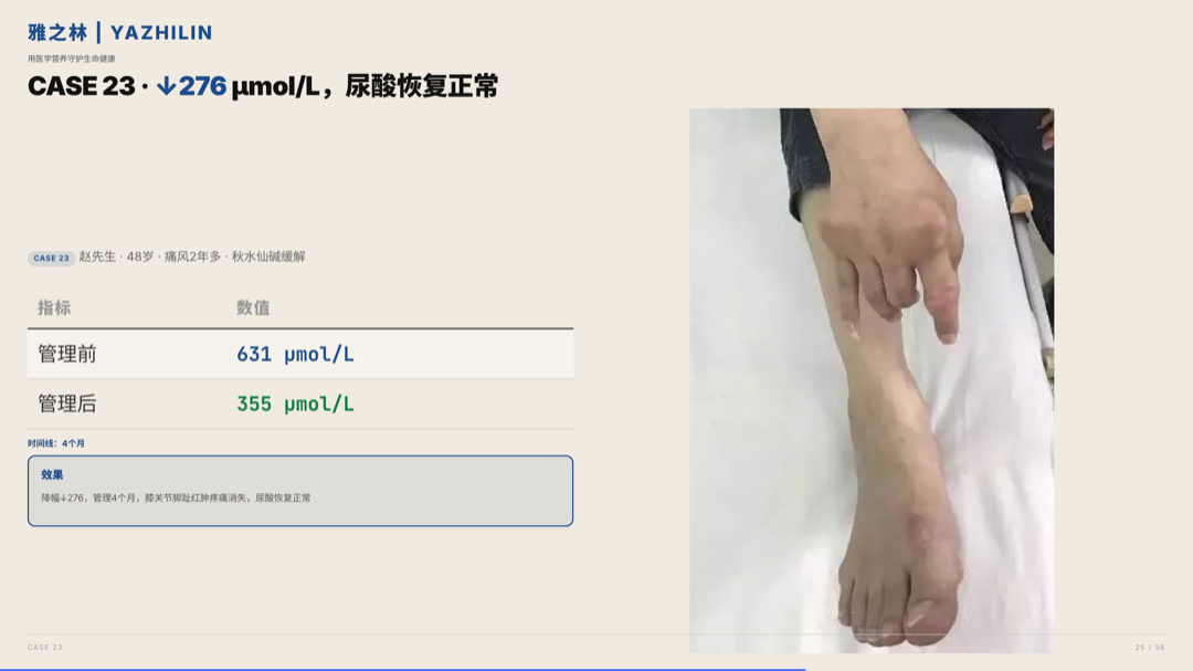 雅之林 痛风高尿酸 案例分析 第25页