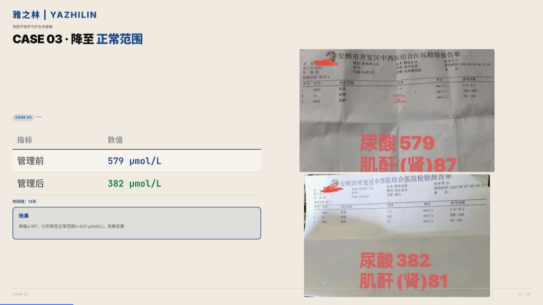 雅之林 痛风高尿酸 案例分析 第5页