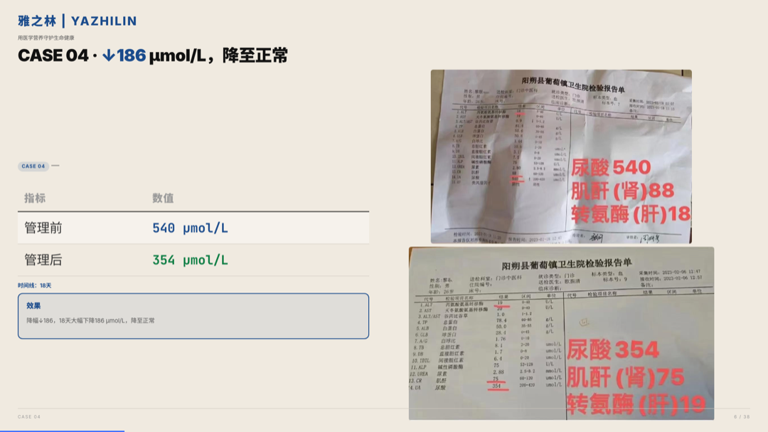 雅之林 痛风高尿酸 案例分析 第6页
